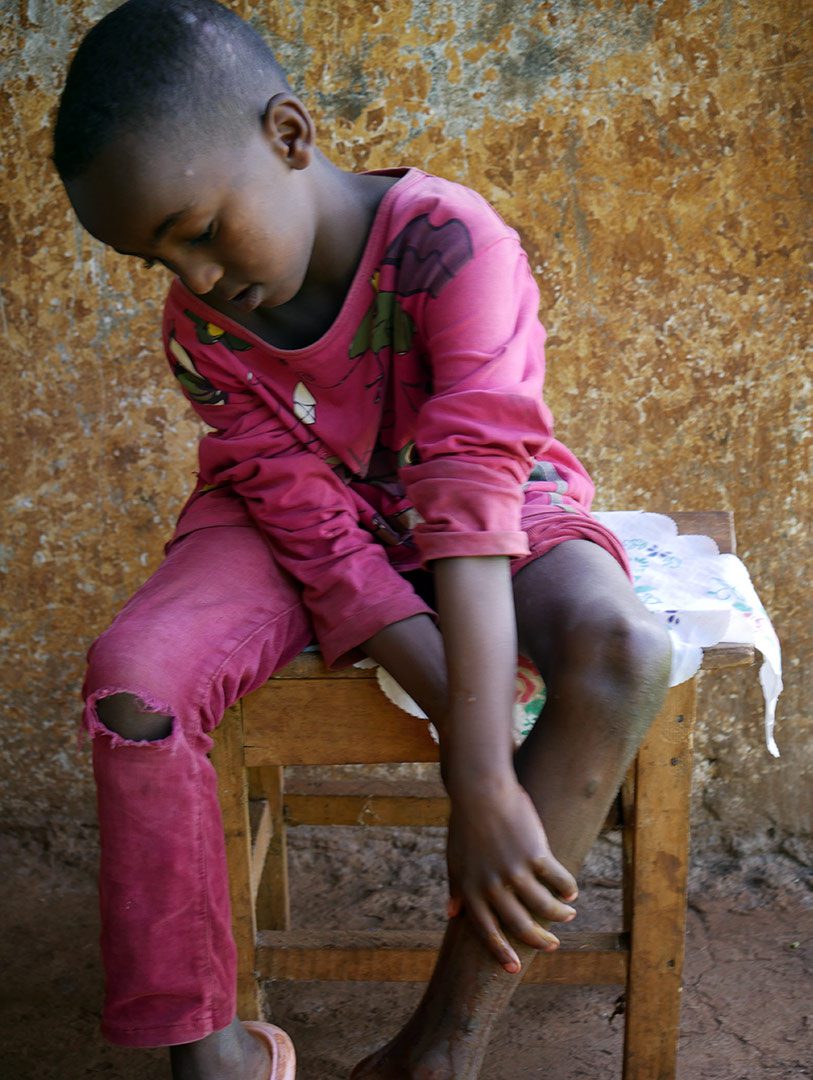 A boy sits on a wooden stool and washes his leg, medical care